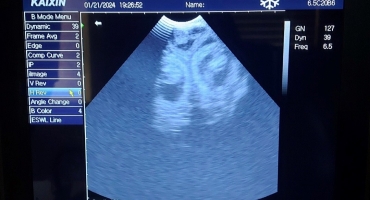 Ultrasound Scan