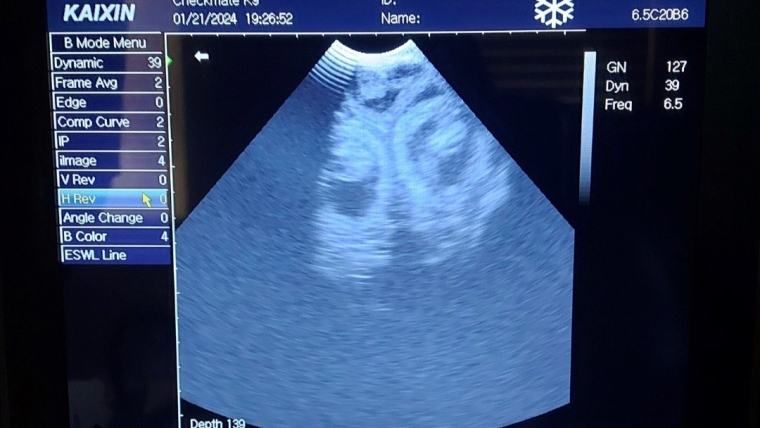 Ultrasound Scan