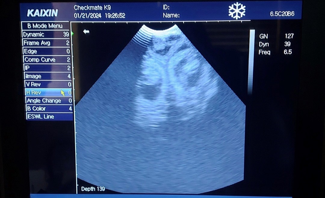 Ultrasound Scan